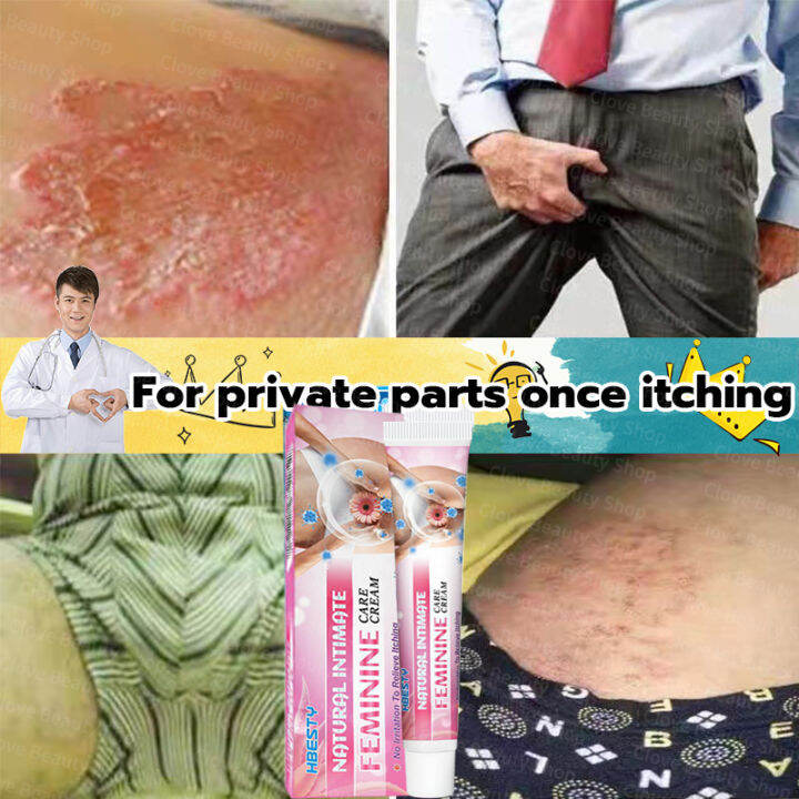 HBESTY 20g Ointment for itchy skin and allergy For the treatment of