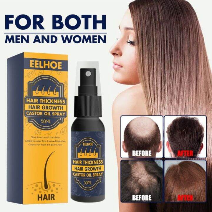 📌 Hair growth castor oil spray สเปรย์ดูแลหนังศรีษะลดการหลุดล่วงของเส้นผม สเปรย์บำรุงผมล่วง50ml