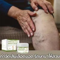 ส่งจากไทยค่ะ EELHOE 50g ครีมทาเส้นเลือดขอด รักษาขาให้สวย ลดอาการบวมขา ส่งเสริมการไหลเวียนโลหิต บอกลาขาไส้เดือน Varicose Vein Cream【COD】