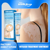 South Moon White Spot Vitiligo Treament Ointment 20G Local Vitiligo Ointment Mycosis Leukoplakia Treatment Vitiligo Ointment ลบจุดสีขาว