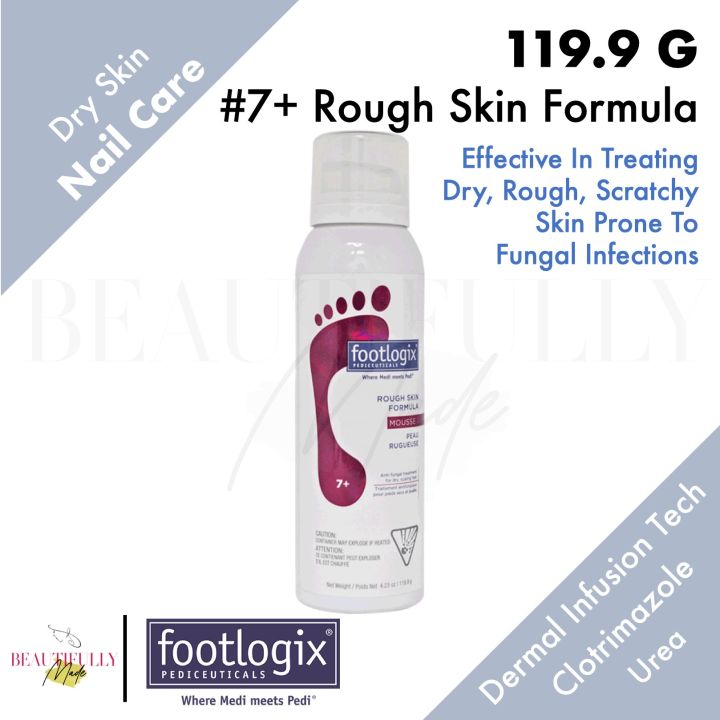 Footlogix 7+ Rough Skin Formula Mousse 119.9g - For Dry Scaling Feet ...