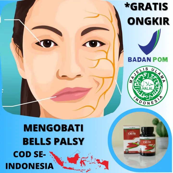 Obat Bells Palsy, Herbal Penyakit Bells Palsy, Mengobati Struk Di Wajah ...