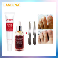 【2023】LANBENA Nail Repair Essence Serum Nail Care Gel Nail Treatment ลบ Onychomycosis Toe Nail Nourishing Hand และ Foot Care 2ชิ้น