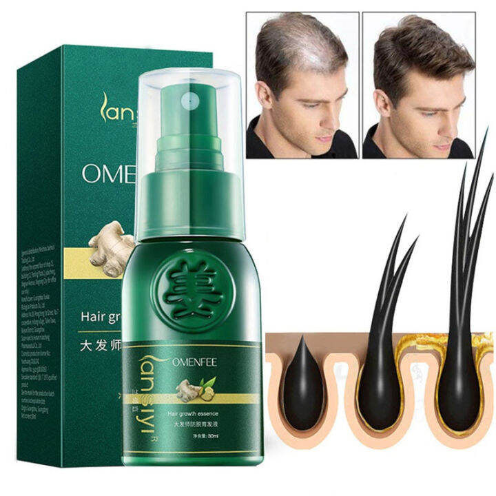Hair Growth Spray Serum Anti Hair Loss Products Fast Grow Prevent Hair