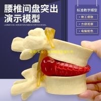 Human spine model of lumbar spine bone mould vertebral body highlight osteoporosis compression of pathology teaching AIDS