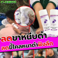 C-gress เช็ดคอดำ รักแร้ ตาตุ่ม หายถาวร 100 ml   1 ขวด