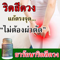 ?ไม่ต้องผ่าตัด? สมุนไพร เพชรสังฆาตแคปซูล 50 แคปซูล ยาริดสีดวงทวาน ยาแก้ริดสีดวงริดสีดวงหายขาด แก้ริดสีดวง ยาทานริดสีดวง ริดสีดวงหาย