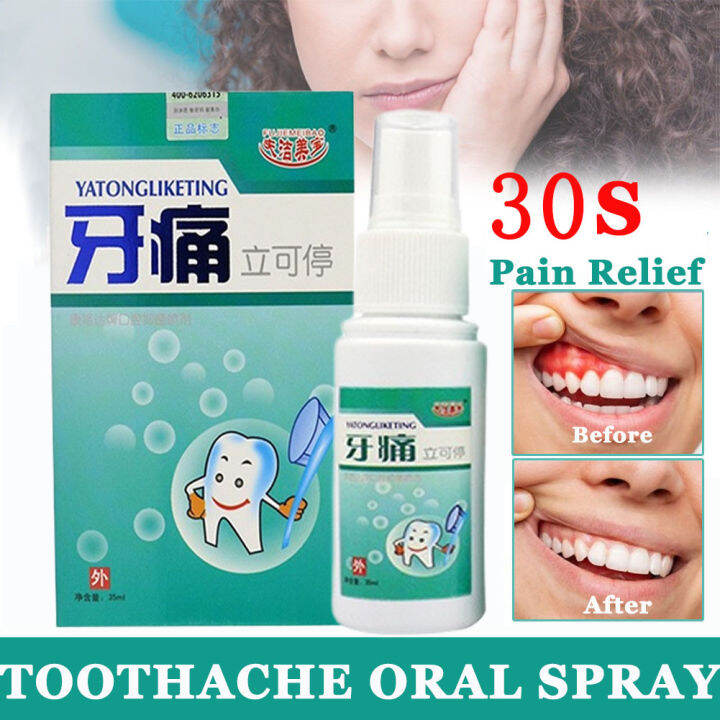 Toothache Spray Relieves Periodontitis Tooth Decay Pains Toothache