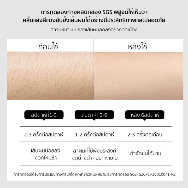 มีของขวัญ-amiro-a1-เครื่องกำจัดขน-ipl-ระบบเย็น-คลื่นแสงสีแดง-ไม่เจ็บ-พร้อม-เลเซอร์ผิวหน้า-เครื่องเลเซอร์กำจัดขน-เลเซอร์