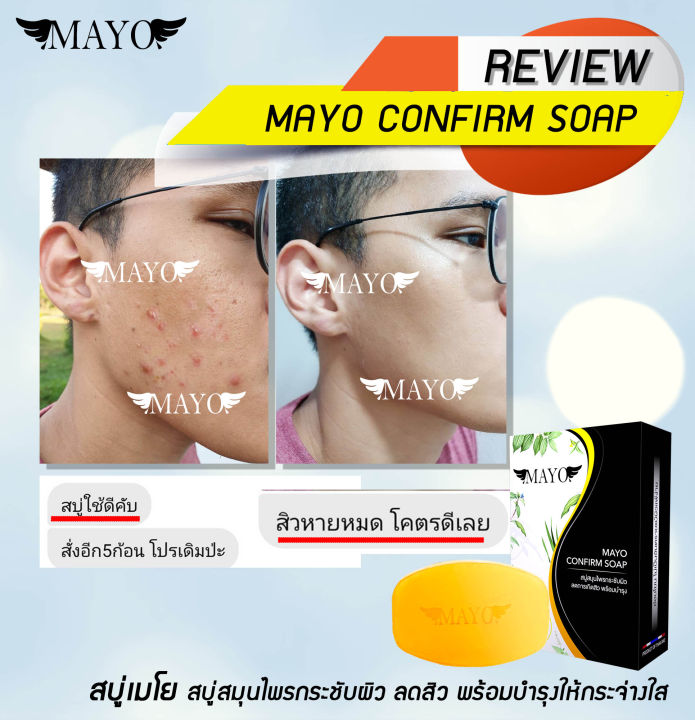 สบู่เมโย-หน้าใส-กระชับผิว-ลดสิว-พร้อมบำรุงให้ขาวใส-mayo-soap-สารสกัดจากธรรมชาติมากกว่า-10-ชนิด