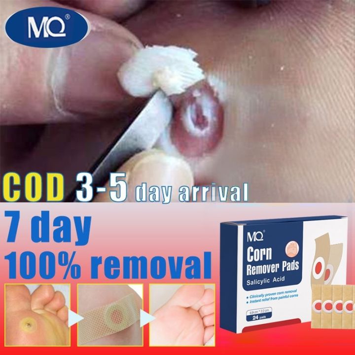 New 2023 24pcs Foot Corns Remover Patch Remove Calluses On The Feet