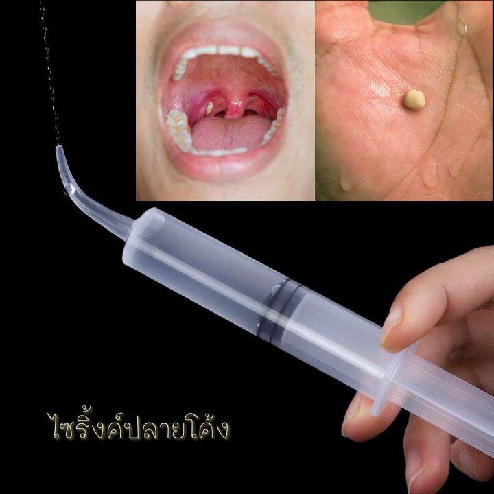»ไซริงค์ กำจัดนิ่วทอนซิล tonsil stone ไซริ้งค์ปลายโค้ง Dental