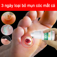 Mụn cơm Tẩy nốt ruồi Dung dịch loại bỏ mụn mắt cá Loại bỏ mụn cóc Mụn cóc