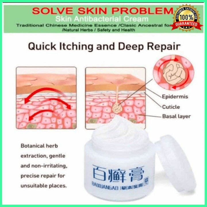 18gm Baixuangao ointment cream for psoriasis, fungal infection