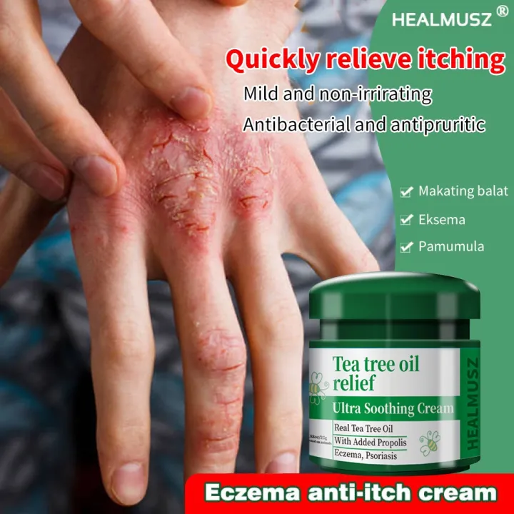 HEALMUSZ Anti-itch cream dermatitis eczema itchy skin remedy psoriasis ...