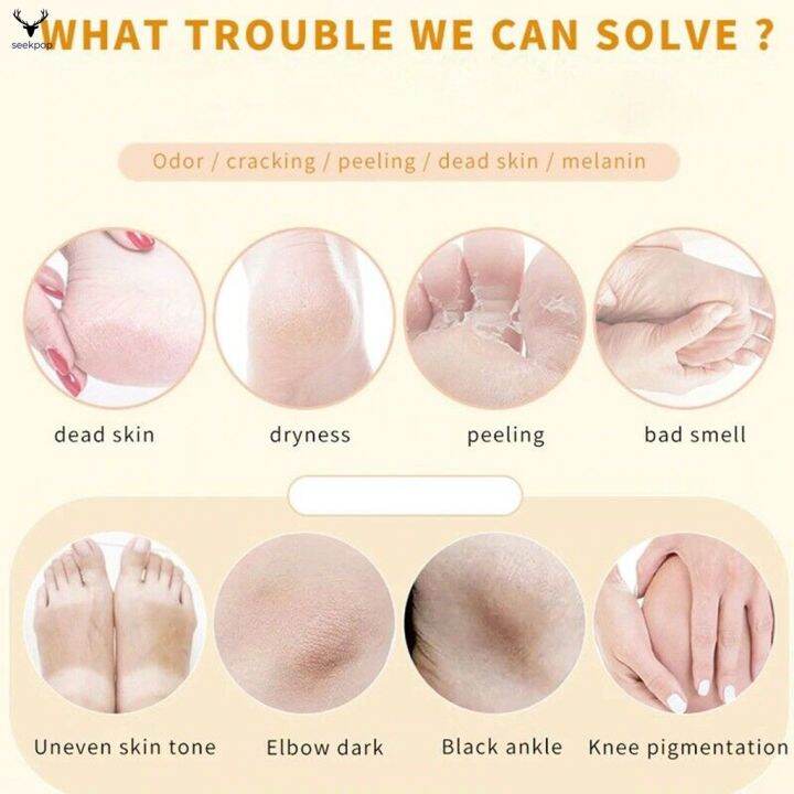 sp-110ml-foot-peeling-spray-elbow-exfoliating-essence-pedicure-cosmetics-for-dead-skin