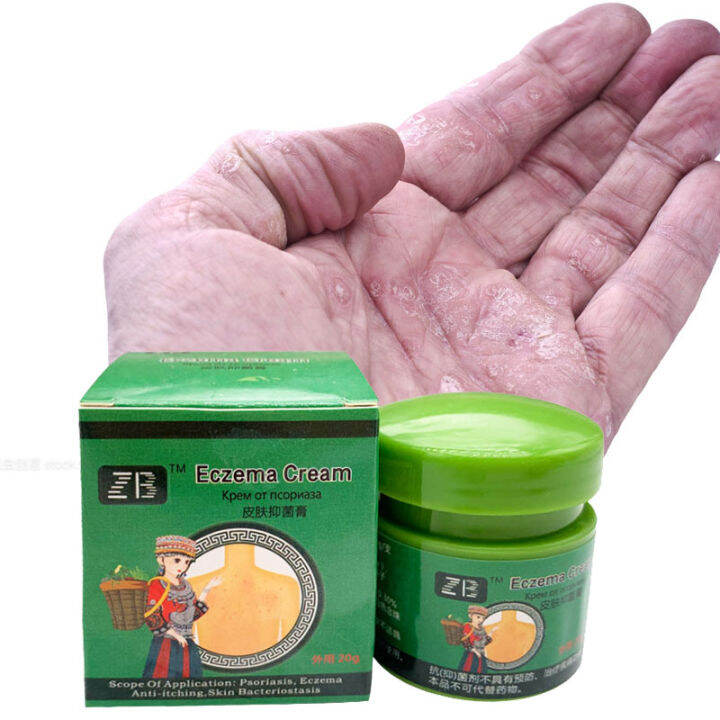 ZB 20g Herbal Ointment Treatment Skin Itching Antibacterial Tinea Pedis