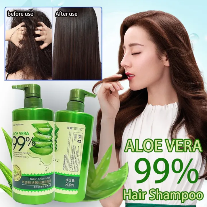 aloe vera shampoo and conditioner Original 100% Aloe Vera Anti-Dandruff  Shampoo 800ml and Aloe