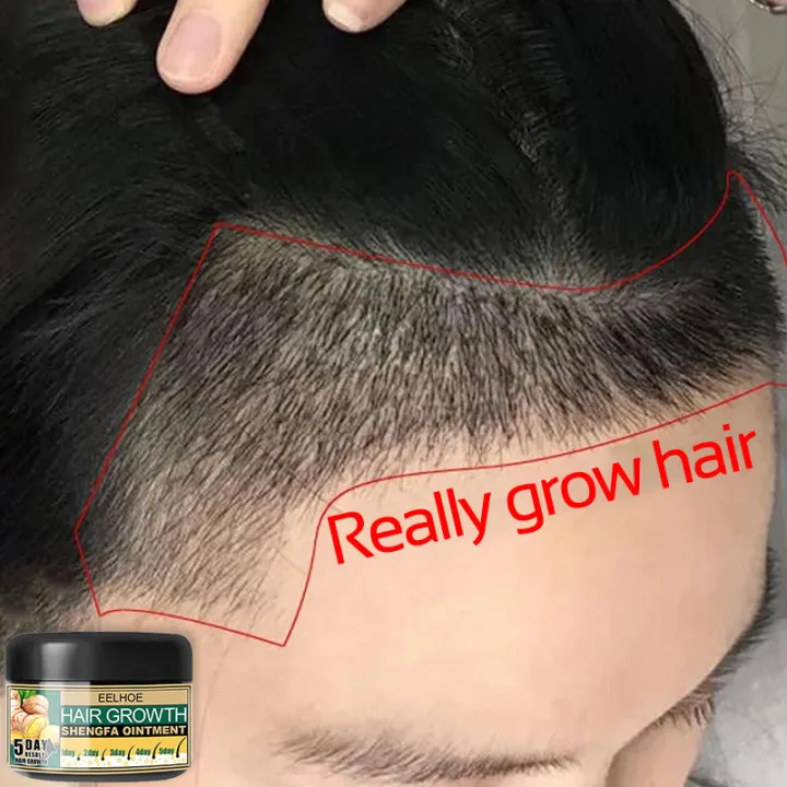 Hair Treatment Hair Grower Minoxidil Hair Growth Nourish Hair Strengthen  Hair Root Nutrition Accelerate Hair Growth