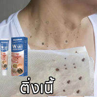 ส่งของจากไทย ขี้แมลงวัน หูดตาปลาและติ่งเนื้อ ของแท้ Corns warts removal พร้อมส่ง แต้ม ทาไฝ ทาขี้แมลงวัน