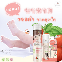 ไออุ่น โรสฮิปเจลบำรุงผิว "ลดรอยดำ" ขาลายยุงกัด ผิวไหม้แดด (aiaoon Natural Rosehip Gel for Face and Body)