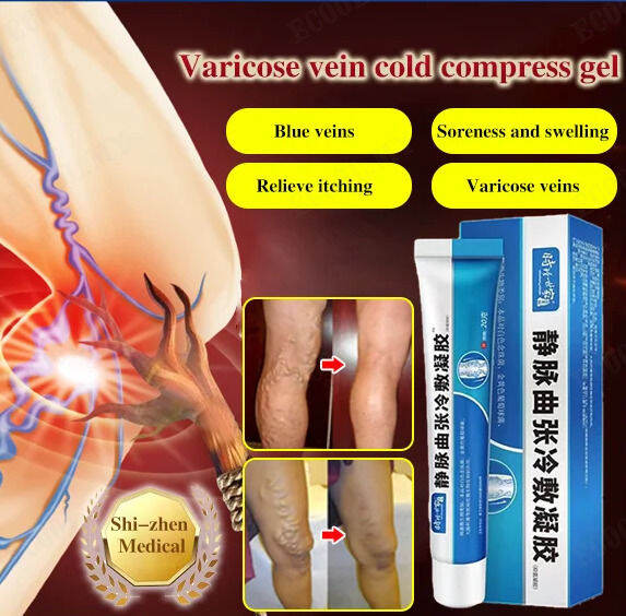 ECOOL Shizhen Medical Varicose Veins Cold Compress Gel Lazada