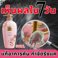 ?สินค้าขายดี?HanFen ยาสระผมแก้เชื้อรา 500ml สูตรธรรมชาติ ติบรรเทาอาการคันหนังศีรษะและทำความสะอาดหนังศีรษะ การควบคุมน้ำมันกรดอะมิโน รังแคไร้กังวล แชมพูขจัดรังแค ยาสระผมรังแค ยาสระผมเชื้อรา แชมพูเกลือทะเล แชมพูกำจัดเชื้อรา แชมพูรักษารังแค ยาสระผมขจัดรังแค