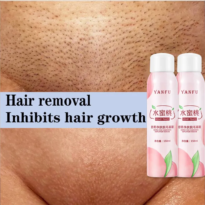 Fragrant and painless 】150ML hair remover permanent hair removal for  underarm hair removal Hair Removal Spray