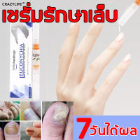 Hellohealings น้ำมันบำรุงเล็บ เล็บขบ เซรั่มรักษาเล็บ น้ำยาบำรุงเล็บ บำรุงเล็บให้สวย เซรั่มบำรุงเล็บ รักษาเล็บ เอ็สเซ้นซ่อมแซมเล็บเสีย ดูแลเล็บ ยาบำรุงเล็บ เล็บหลุดลอก เซรั่มรักษาเล็บพัง เชื้อราที่เล็บ nail care repair