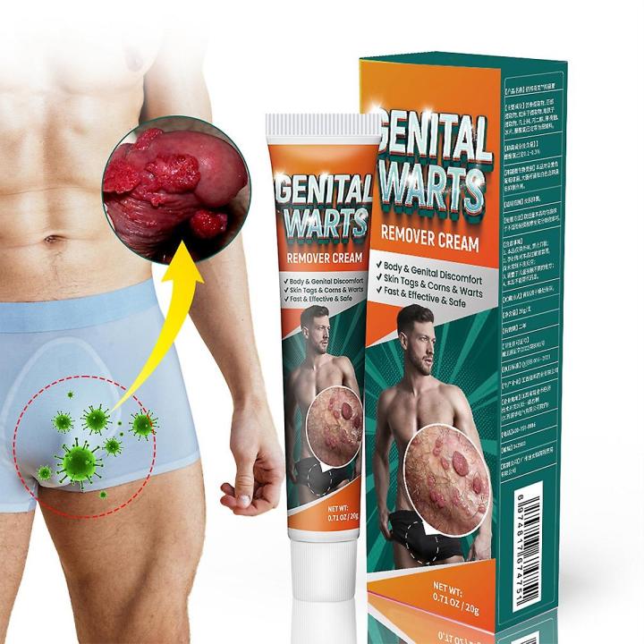 Genital Warts Removal Cream Genital Herpes Wart Remover Ointment Easy