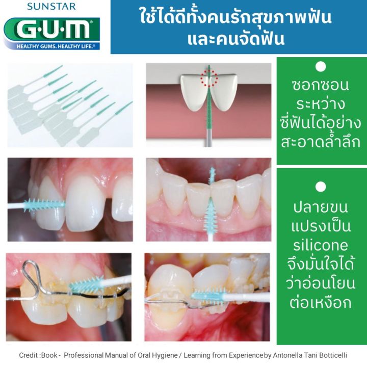 รุ่นใหม่-ปริมาณสุดคุ้ม-50-150-ชิ้น-แพ็ค-gum-soft-picks-comfort-flex-dental-picks-50-100-pcs-pack-gum-soft-pick-แปรงซอกฟัน-แปรงต้นสนเล็ก