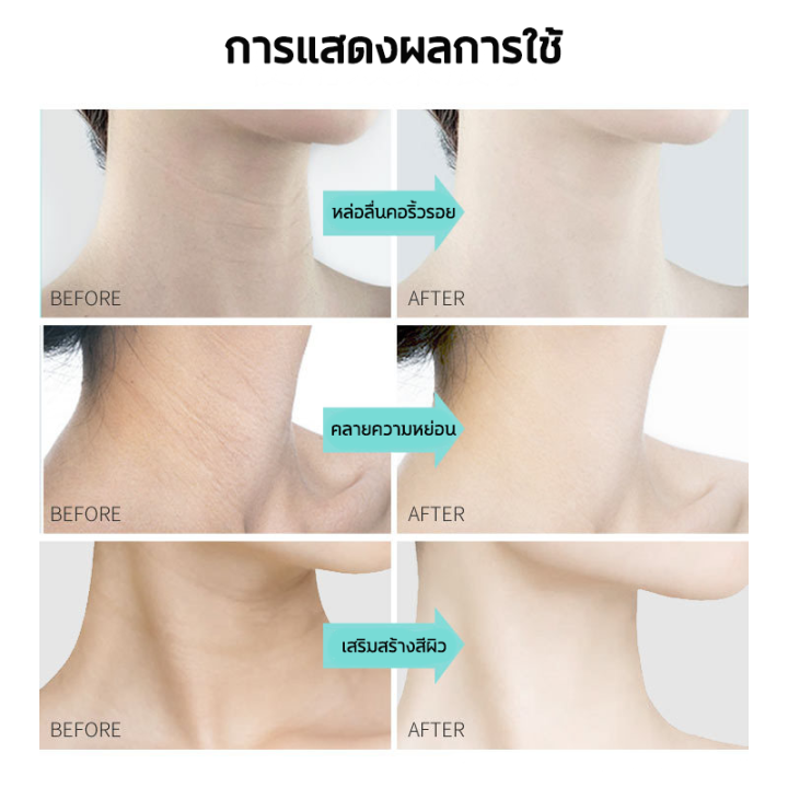 ลดเลือนริ้วรอย-บริเวณลำคอ-pinky-ครีมทาคอ-ลดเลือนริ้วรอย-ครีมทาคอขาว-ครีมลดริ้วรอย-บำรุงผิว-ครีมบำรุงผิวคอ-ครีมยกกระชับ-ครีมบำรุงผิวลำคอ-ครีมบำรุงคอ-ครีมคอขาว-ครีมทาลำคอ-ครีมทาคอย่น-ครีมบำรุงลำคอ-ผิวคอ