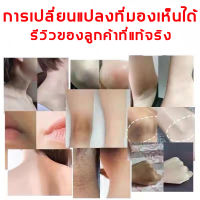 [เค้าเตอร์แบรนด์แท้ 100%พร้อมส่ง]สิ่งประดิษฐ์แก้ข้อศอกดำ kojic acid ครีมทารักแร้ เลือนเมลานิน โลชั่นไวท์เทนนิ่ง ครีมทารักแร้ดำ ครีมทาแก้คอดำ ครีมทาคอดำ ครีมขาหนีบดำ ครีมบำรุงรักแร้ ครีมรักแร้/ครีมทาขาหนีบดำ kojic acid ครีมทาก้นดำ ครีมแก้ขานีบดำ ครีมทาก้น