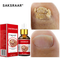 Nail Fungal Treatment Essence Foot Toe Nail Fungus Removal Gel Anti Infection Paronychia Onychomycosis Nail Repair