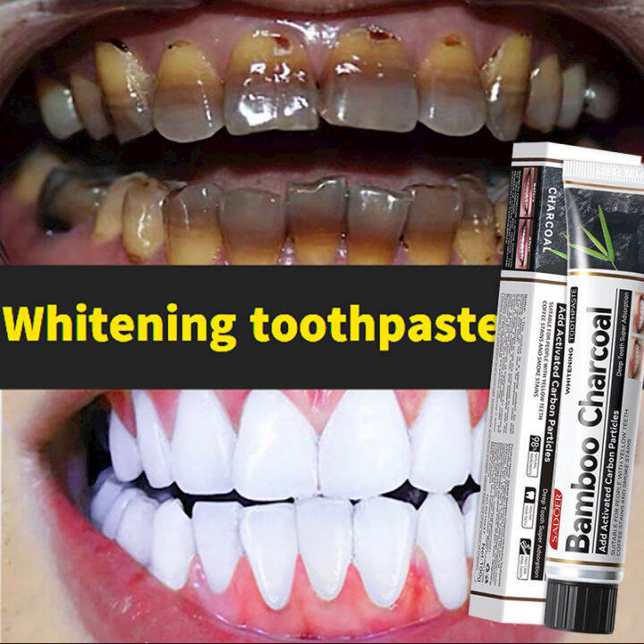 ORIGINAL TEETH WHITENING Whitening Toothpaste Activated Coconut