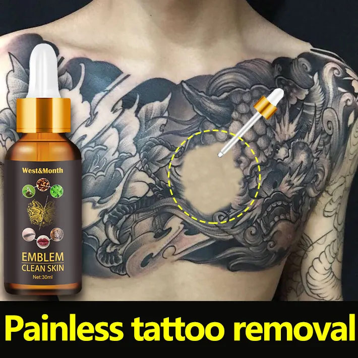 Doctor recommended]Painless Remove Tattoo Removal Cream Tattoo Cleaner  Water Permanent Remove Tattoos,No Skin Damage,No Corrosion,No Scars,Tattoo  Cleaner Water Visible Effect In 3 Weeks Tattoo Cleansing Cream Permanent  Tattoo remover | Lazada PH