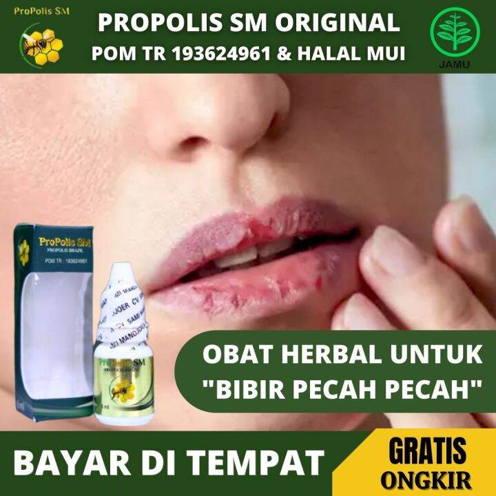 Obat Tetes Bibir Kering Pecah Pecah, Panas Dalam, Sariawan, Perih Di ...