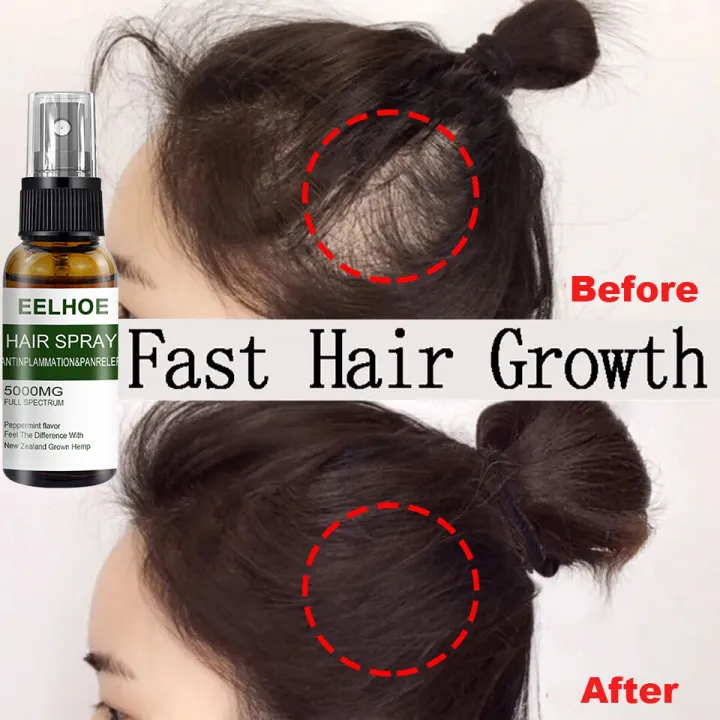 ⚡THICKER HAIR IN 7 DAYS⚡EELHOE Hair Growth Spray 50MLFast Powerful Hair Grower Hair ⚡THICKER HAIR IN 7 DAYS⚡EELHOE Hair Growth Spray 50MLFast Powerful Hair Grower Hair