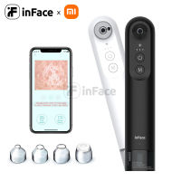 Xiaomi inFace เครื่องดูดสิวมีกล้อง  เครื่องดูดสิว เครื่องดูดสิวเสี้ยน แผ่นลอกสิวเสี้ยน  สำหรับดูรูขุมขน  Visual Blackhead Remover lulucare