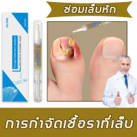 เซรั่มบำรุงเล็บ Nail Fungal Infection เซรั่มซ่อมแซมเล็บ ฆ่าเชื้อราที่เล็บ บำรุงเล็บเสีย บำรุงเล็บ ยากันเชื่อราเล็บ(ที่หยอดเล็บขบ เชื้อราเล็บ รักษาเล็บ เซรั่มรักษาเล็บ ครีมซ่อมแซมเล็บ น้ำยาฆ่าเชื้อราที่เล็บ ครีมบำรุงซ่อมแซมเล็บ	น้ำยาใส่เล็บขบ ครีมบำรุงเล็บ