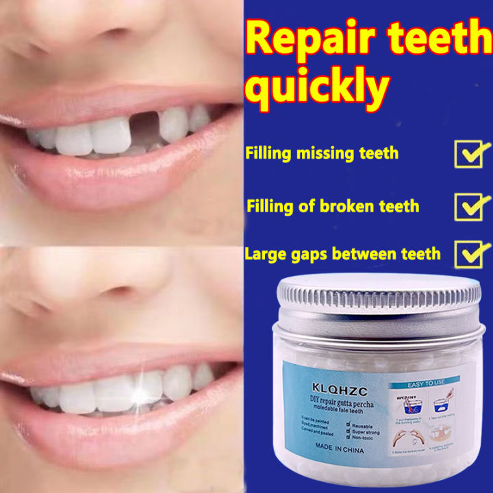 Tooth Repair Kit-Thermal Beads For Filling Fix The Missing And Broken Tooth  Or Adhesive The Denture Fake Teeth Veneer 50g/100g Moldable False Teeth