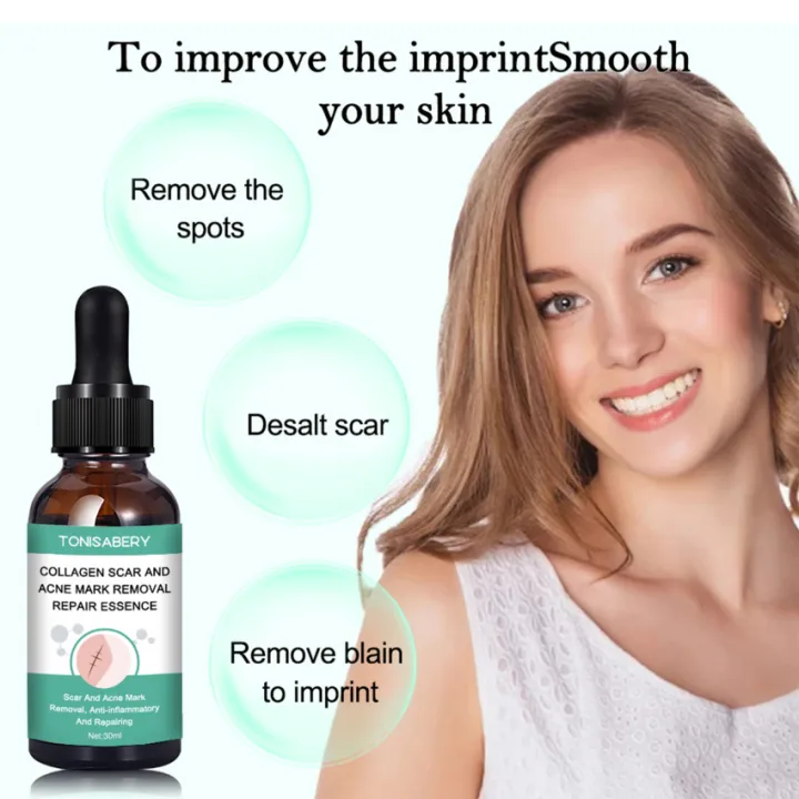 【Ready Stock】30ml Fade Marks Essence Universal Scar Removal Care Fluid Mild Multifunctional