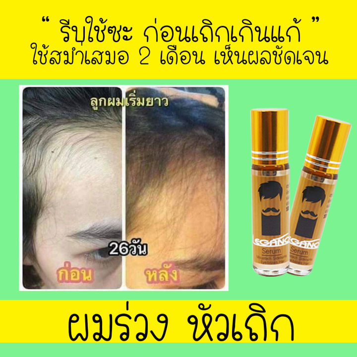 สุดคุ้ม-legano-serum-เซรั่มปลูกคิ้ว-บำรุงคิ้ว-ปลูกคิ้ว-ปลูกหนวด-ปลูกขนตา-เซรั่มปลูกผม-แพ็ค12-แถมฟรี-สเปรย์ฉีดผม-เร่งผมยาว-แก้ปัญหาได้ตรงจุด