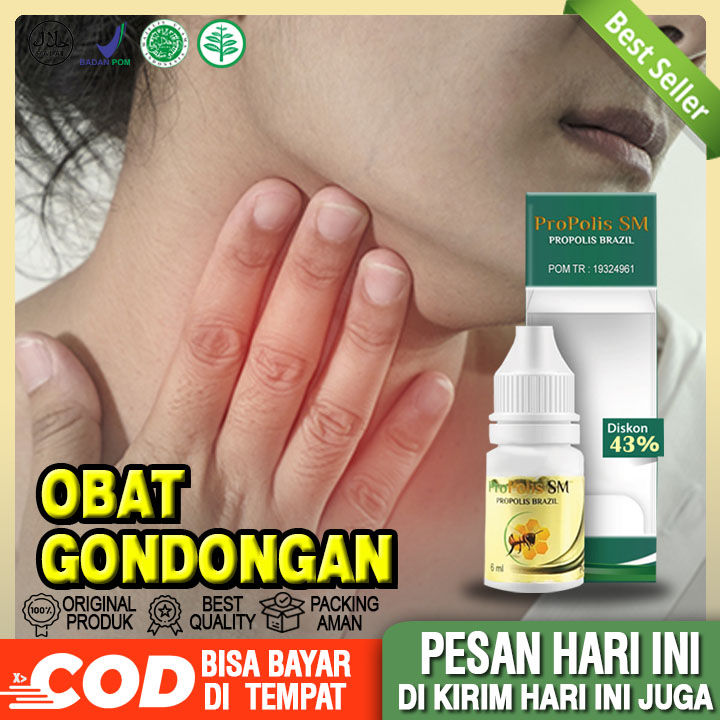 Cara Ampuh Atasi Gondongan Secara Alami dan Cepat!