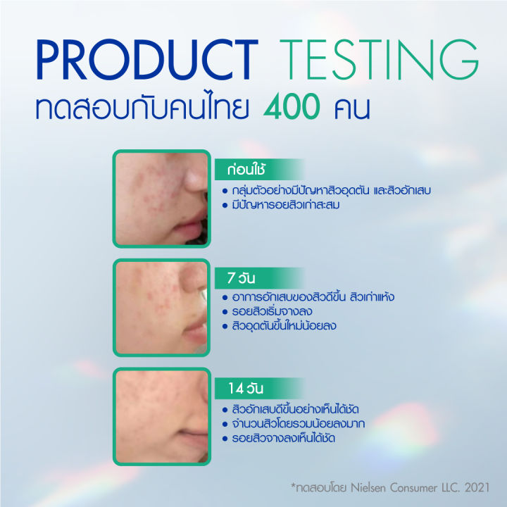 nivea-นีเวีย-แอคเน่-แคร์-ซุปเปอร์-เซรั่ม-7-มล-1-กล่อง-x-6-ซอง-เซรั่ม-บำรุงผิวหน้า-ลดปัญหาสิวและรอยสิว-ลดปัญหาสิวเกิดซ้ำ