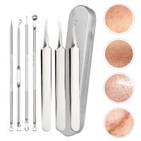 【cw】 4Pcs/set Blackhead Removal Needles Dots Cleaner Extractor Acne Treatment Needle Face 1