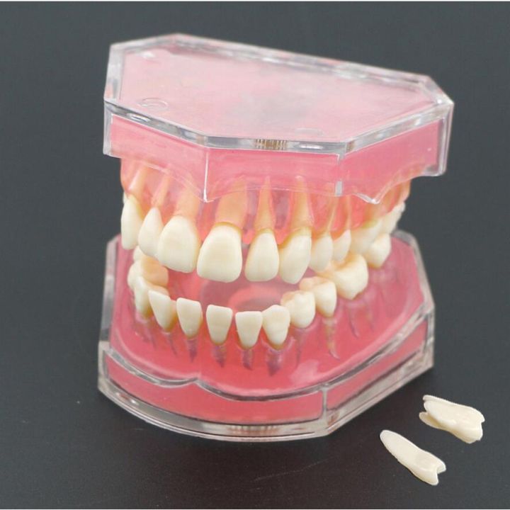Mô hình hàm răng người trong suốt