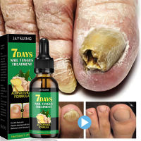 การรักษาเชื้อราที่เล็บ Essence Oil Foot Toe Nail Fungus Removal Serum 7 Days Repair Onychomycosi Anti Infection Gel Care Products