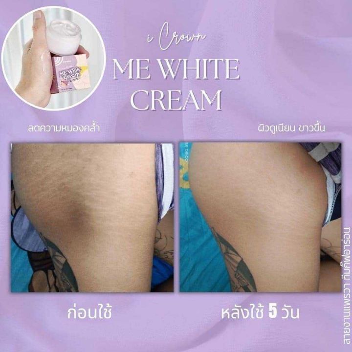 ขายดี-ของแท้-ครีมทาง่ามขาแอนนา-ครีมแอนนา-ไอเคราน์มีไวท์ครีม-crown-me-white-cream-ครีมทาง่ามขาหนีบดำ-ครีมทาในที่ลับ-me-amp-u99