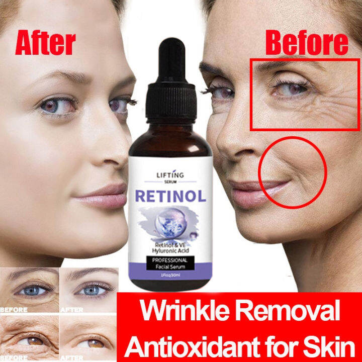 Retinol Serum For Face Anti Wrinkle Remove Dark Spots Face Essence Anti Aging Brightening 7105